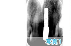 症例4-3