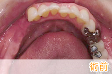 症例14