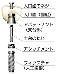 トラブルに強く、美しい02