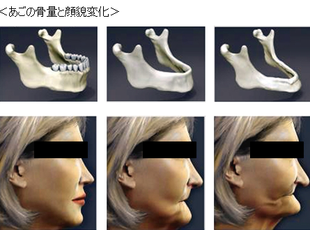 いつまでも若々しい顔貌を01