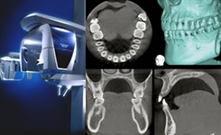 歯科用CT画像分析システム